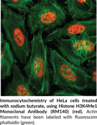 Histone H3K4Me1 Monoclonal Antibody (RM140)