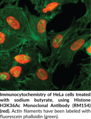 Histone H3K36Ac Monoclonal Antibody (RM154)