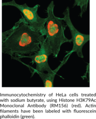 Histone H3K79Ac Monoclonal Antibody (RM156)