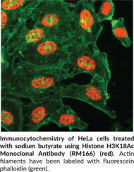 Histone H3K18Ac Monoclonal Antibody (RM166)