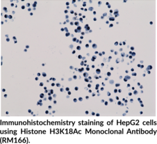Histone H3K18Ac Monoclonal Antibody (RM166)