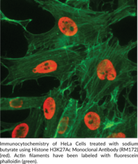 Histone H3K27Ac Monoclonal Antibody (RM172)