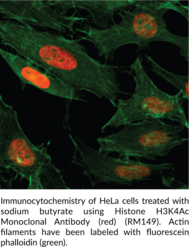 Histone H3K4Ac Monoclonal Antibody (RM149)