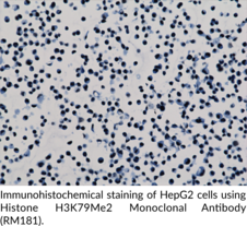 Histone H3K79Me2 Monoclonal Antibody (RM181)