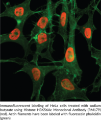 Histone H3K56Ac Monoclonal Antibody (RM179)