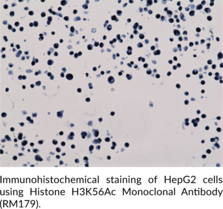 Histone H3K56Ac Monoclonal Antibody (RM179)