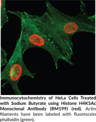 Histone H4K5Ac Monoclonal Antibody (RM199)