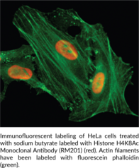 Histone H4K8Ac Monoclonal Antibody (RM201)