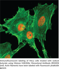 Histone H4K20Ac Monoclonal Antibody (RM205)