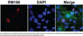 Histone H3K4 Monoclonal Antibody (RM186)