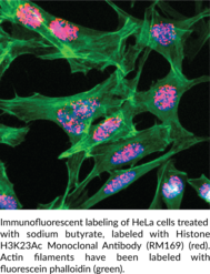 Histone H3K23Ac Monoclonal Antibody (RM169)