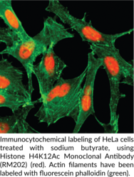 Histone H4K12Ac Monoclonal Antibody (RM202)