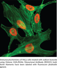 Histone H2A.ZK4Ac Monoclonal Antibody (RM221)