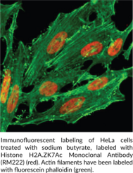 Histone H2A.ZK7Ac Monoclonal Antibody (RM222)