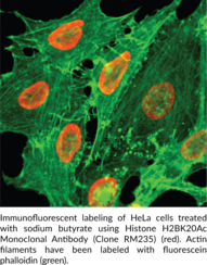 Histone H2BK20Ac Monoclonal Antibody (Clone RM235)