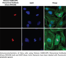 Histone H2BS14Ph Monoclonal Antibody (Clone RM238)