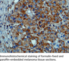 B-RAFV600E Monoclonal Antibody (Clone RM8)