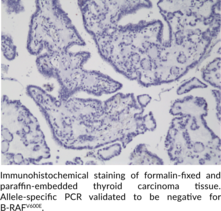 B-RAFV600E Monoclonal Antibody (Clone RM8)