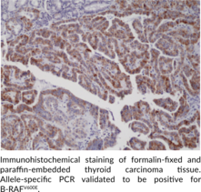 B-RAFV600E Monoclonal Antibody (Clone RM8)