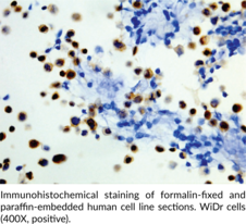 B-RAFV600E Monoclonal Antibody (Clone RM8)