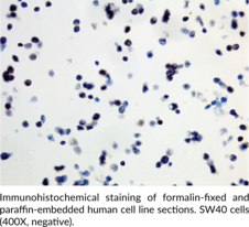 B-RAFV600E Monoclonal Antibody (Clone RM8)