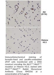 Akt1E17K/Akt2E17K Rabbit Monoclonal Antibody (Clone RM336)