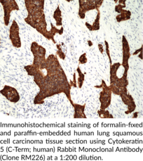 Cytokeratin 5 (C-Term; human) Rabbit Monoclonal Antibody (Clone RM226)