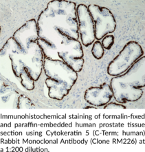Cytokeratin 5 (C-Term; human) Rabbit Monoclonal Antibody (Clone RM226)