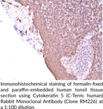 Cytokeratin 5 (C-Term; human) Rabbit Monoclonal Antibody (Clone RM226)