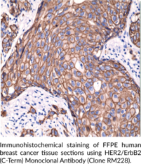 HER2/ErbB2 (C-Term) Monoclonal Antibody (Clone RM228)