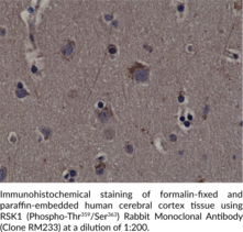 RSK1 (Phospho-Thr359/Ser363) Rabbit Monoclonal Antibody (Clone RM233)