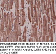 Desmin Monoclonal Antibody (Clone RM234)