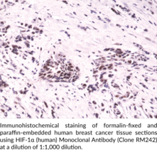 HIF-1α (human) Monoclonal Antibody (Clone RM242)