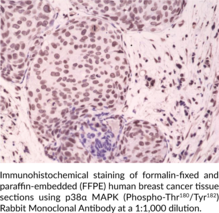 p38α MAPK (Phospho-Thr180/Tyr182) Rabbit Monoclonal Antibody (Clone RM243)