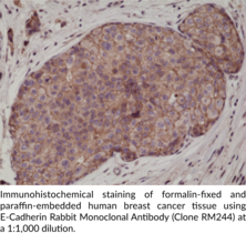 E-Cadherin Rabbit Monoclonal Antibody (Clone RM244)