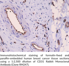 CD31 Rabbit Monoclonal Antibody (Clone RM247) (Cluster of Differentiation 31, EndoCAM, GPIIA, PECA1, Platelet Endothelial Cell Adhesion Molecule (PECAM-1))