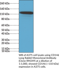 CD146 Long Rabbit Monoclonal Antibody (Clone RM249) (LgCD146, CD146-L, MUC18, MCAM-1)
