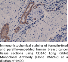CD146 Long Rabbit Monoclonal Antibody (Clone RM249)
