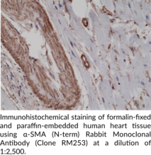 α-SMA (N-Term) Rabbit Monoclonal Antibody (Clone RM253)
