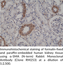 α-SMA (N-Term) Rabbit Monoclonal Antibody (Clone RM253)