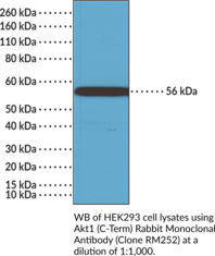 Akt1 (C-Term) Rabbit Monoclonal Antibody (Clone RM252) (Protein Kinase Bα, PKBα, RAC-α Serine/threonine-protein Kinase)
