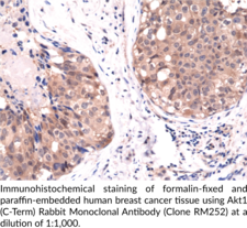 Akt1 (C-Term) Rabbit Monoclonal Antibody (Clone RM252)