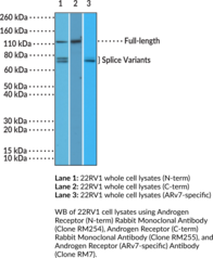 Androgen Receptor (N-Term) Rabbit Monoclonal Antibody (Clone RM254) (AR, NR3C4, Nuclear Receptor Subfamily 3 Group C Member 4)