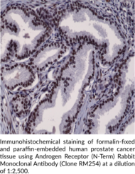 Androgen Receptor (N-Term) Rabbit Monoclonal Antibody (Clone RM254)