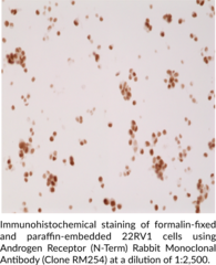 Androgen Receptor (N-Term) Rabbit Monoclonal Antibody (Clone RM254)