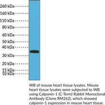 Calponin-1 (C-Term) Rabbit Monoclonal Antibody (Clone RM262) (CaP)