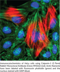Calponin-1 (C-Term) Rabbit Monoclonal Antibody (Clone RM262)