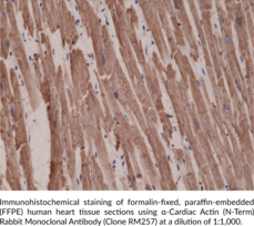 α-Cardiac Actin (N-Term) Rabbit Monoclonal Antibody (Clone RM257)