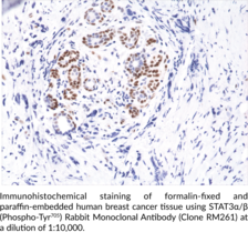 STAT3α/β (Phospho-Tyr705) Rabbit Monoclonal Antibody (Clone RM261)