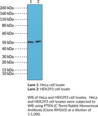 PTEN (C-Term) Rabbit Monoclonal Antibody (Clone RM265) (MMAC1, Mutated in Multiple Advanced Cancers 1, Phosphatase and Tensin Homolog, TEP1)